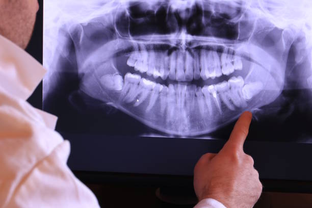 Best Emergency Dental Surgery in Elkins, AR