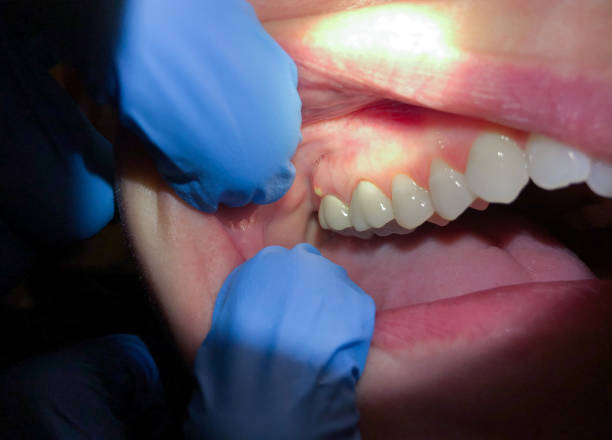 Best Emergency Treatment for Toothache in Elkins, AR