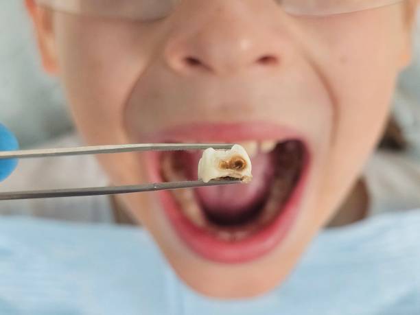 Best After-Hours Emergency Dentist in Elkins, AR